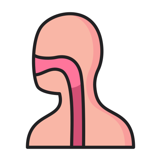 Tracheoesophageal Fistula
